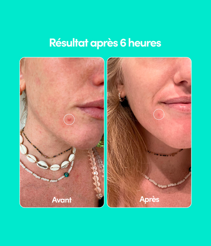 DUO Stop Boutons - Visage et Corps Unicorn
