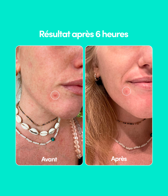 DUO Stop Boutons - Visage et Corps